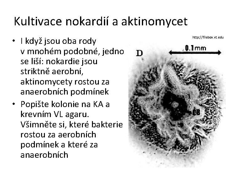 Kultivace nokardií a aktinomycet • I když jsou oba rody v mnohém podobné, jedno