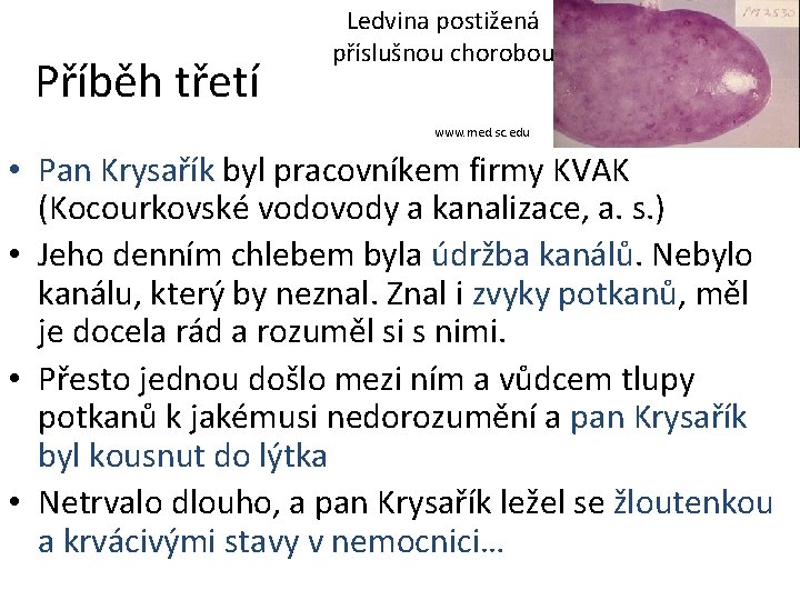 Příběh třetí Ledvina postižená příslušnou chorobou www. med. sc. edu • Pan Krysařík byl