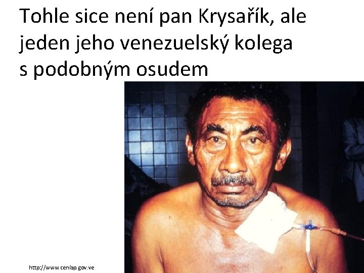 Tohle sice není pan Krysařík, ale jeden jeho venezuelský kolega s podobným osudem http: