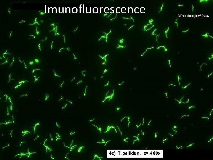Imunofluorescence Mikrobiologický ústav 