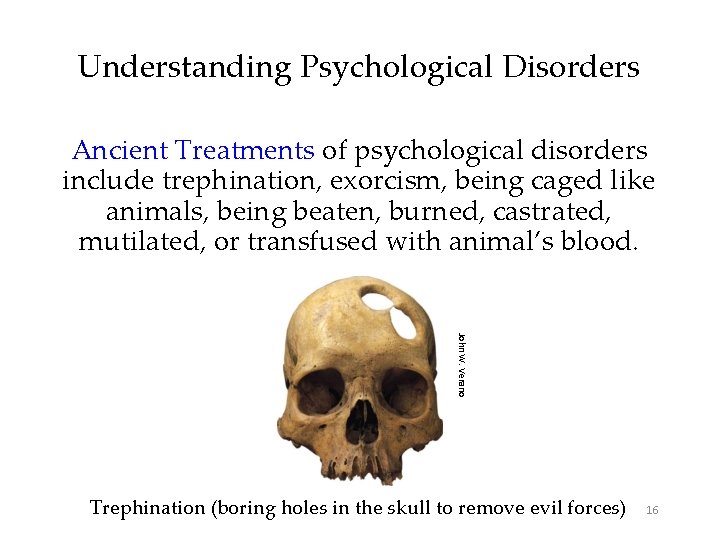 Understanding Psychological Disorders Ancient Treatments of psychological disorders include trephination, exorcism, being caged like