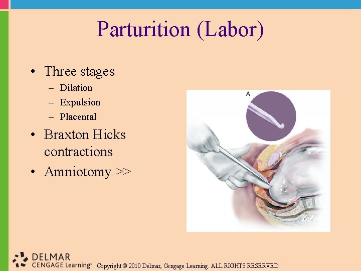 Parturition (Labor) • Three stages – Dilation – Expulsion – Placental • Braxton Hicks