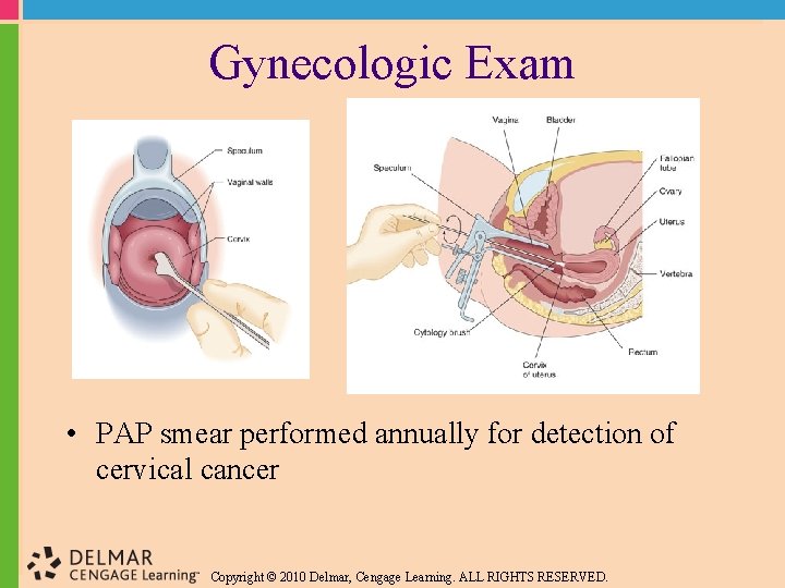 Gynecologic Exam • PAP smear performed annually for detection of cervical cancer Copyright ©