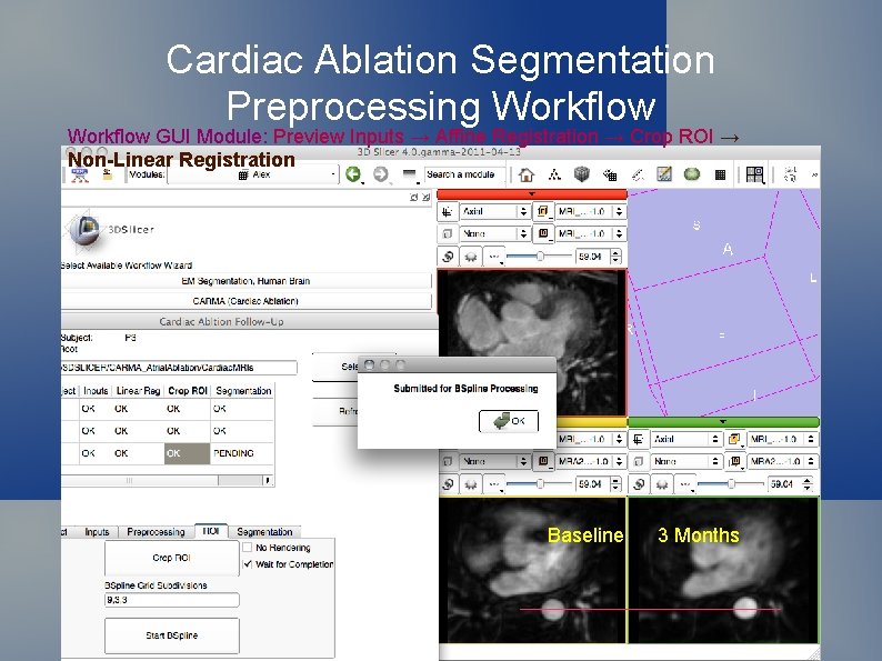 Cardiac Ablation Segmentation Preprocessing Workflow GUI Module: Preview Inputs → Affine Registration → Crop