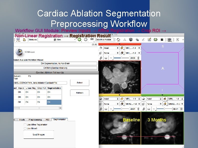 Cardiac Ablation Segmentation Preprocessing Workflow GUI Module: Preview Inputs → Affine Registration → Crop