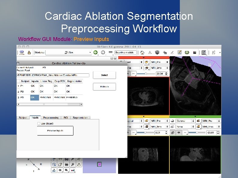 Cardiac Ablation Segmentation Preprocessing Workflow GUI Module: Preview Inputs 