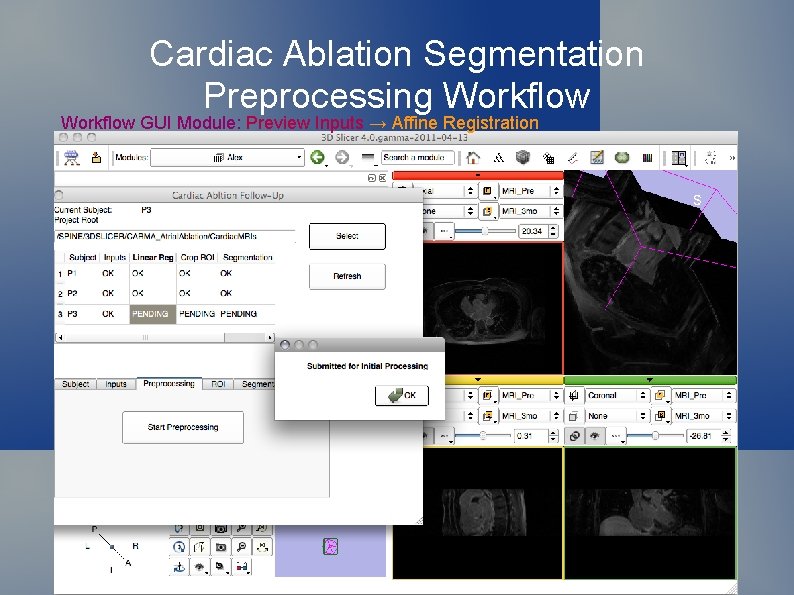 Cardiac Ablation Segmentation Preprocessing Workflow GUI Module: Preview Inputs → Affine Registration 