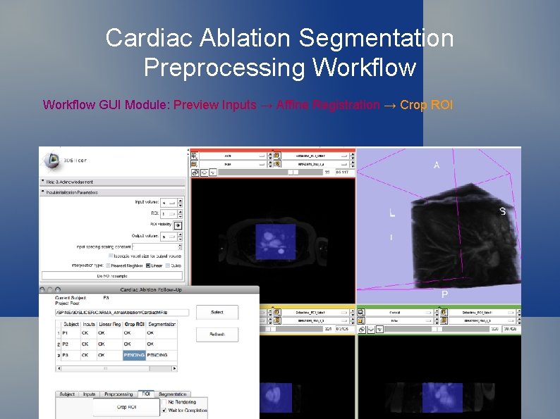 Cardiac Ablation Segmentation Preprocessing Workflow GUI Module: Preview Inputs → Affine Registration → Crop