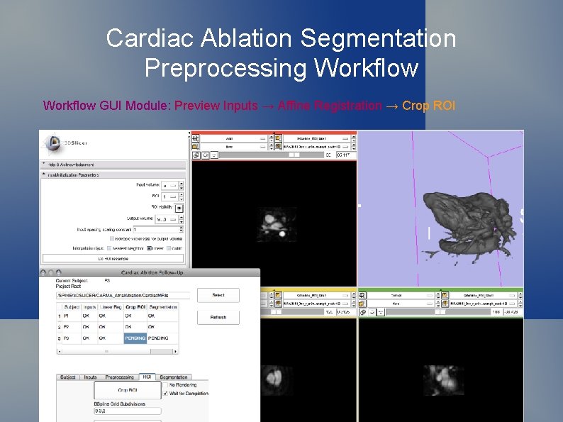 Cardiac Ablation Segmentation Preprocessing Workflow GUI Module: Preview Inputs → Affine Registration → Crop