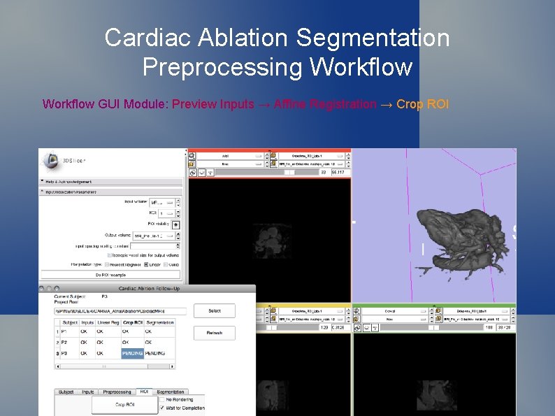 Cardiac Ablation Segmentation Preprocessing Workflow GUI Module: Preview Inputs → Affine Registration → Crop