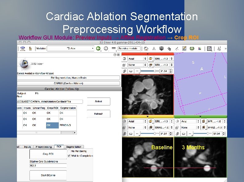 Cardiac Ablation Segmentation Preprocessing Workflow GUI Module: Preview Inputs → Affine Registration → Crop