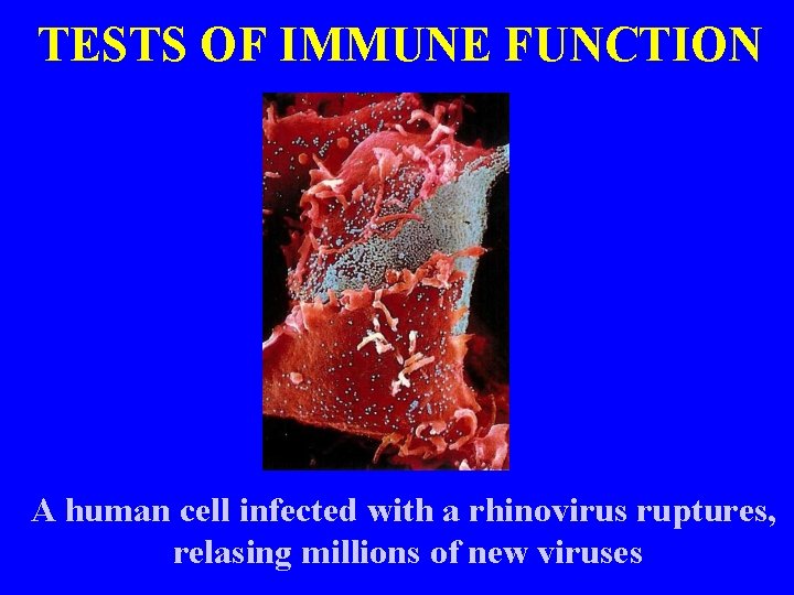 TESTS OF IMMUNE FUNCTION A human cell infected with a rhinovirus ruptures, relasing millions