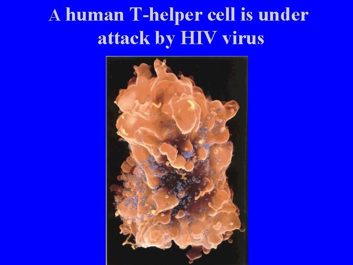 A human T-helper cell is under attack by HIV virus 