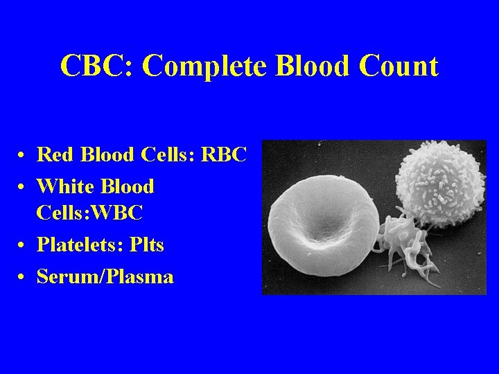 CBC: Complete Blood Count • Red Blood Cells: RBC • White Blood Cells: WBC