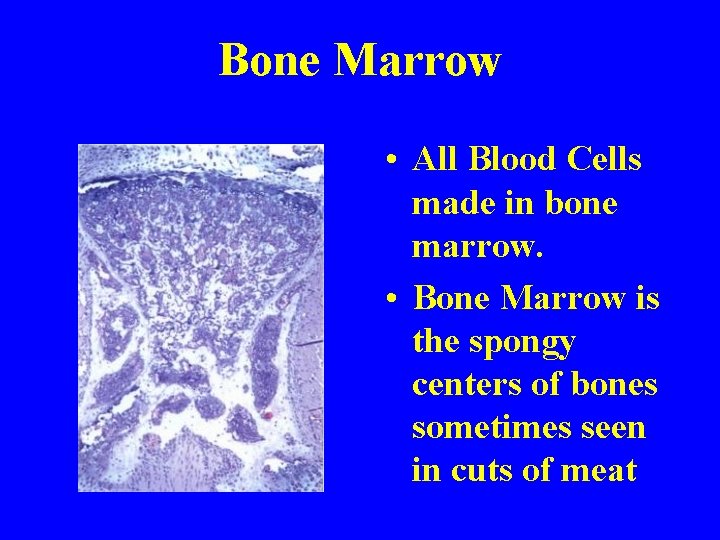 Bone Marrow • All Blood Cells made in bone marrow. • Bone Marrow is