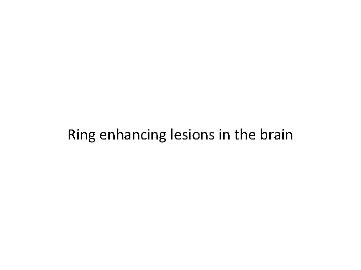 Ring enhancing lesions in the brain 