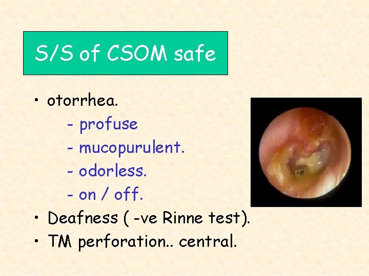 S/S of CSOM safe • otorrhea. - profuse - mucopurulent. - odorless. - on