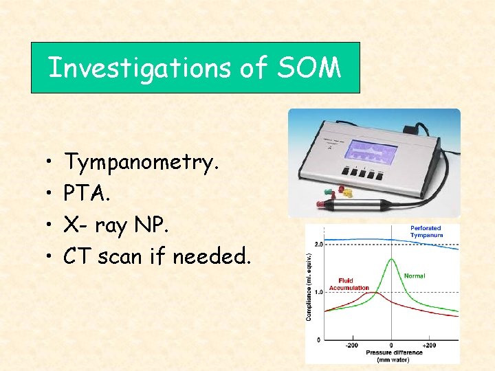 Investigations of SOM • • Tympanometry. PTA. X- ray NP. CT scan if needed.