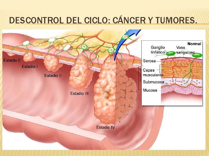 DESCONTROL DEL CICLO: CÁNCER Y TUMORES. 