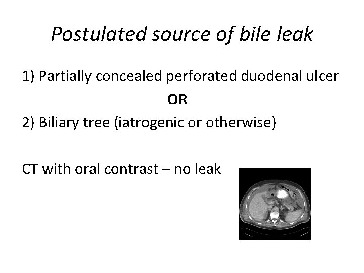 Postulated source of bile leak 1) Partially concealed perforated duodenal ulcer OR 2) Biliary