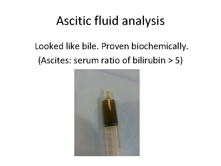 Ascitic fluid analysis Looked like bile. Proven biochemically. (Ascites: serum ratio of bilirubin >