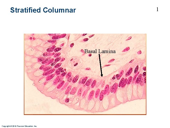 1 Stratified Columnar Basal Lamina Copyright © 2010 Pearson Education, Inc. 