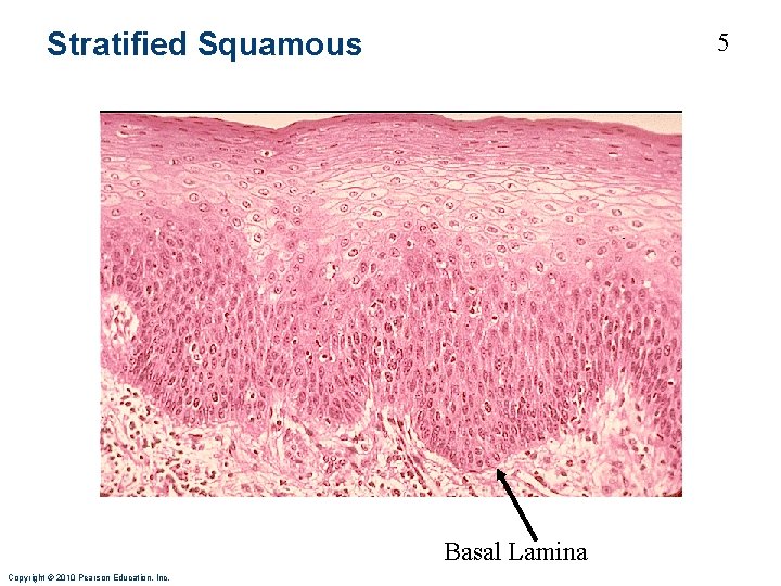 Stratified Squamous 5 Basal Lamina Copyright © 2010 Pearson Education, Inc. 