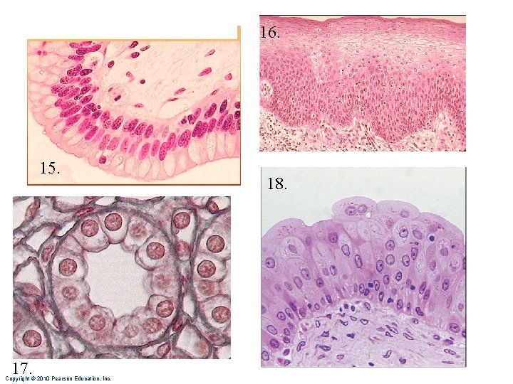 16. 15. 17. Copyright © 2010 Pearson Education, Inc. 18. 
