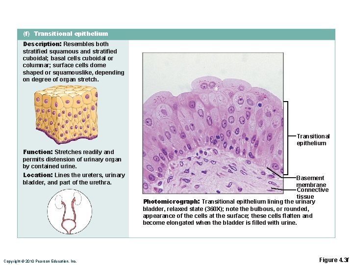 (f) Transitional epithelium Description: Resembles both stratified squamous and stratified cuboidal; basal cells cuboidal