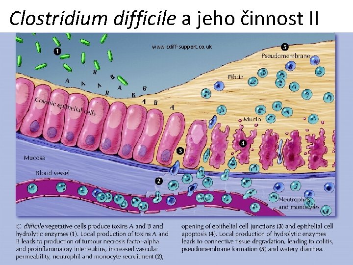 Clostridium difficile a jeho činnost II www. cdiff-support. co. uk 