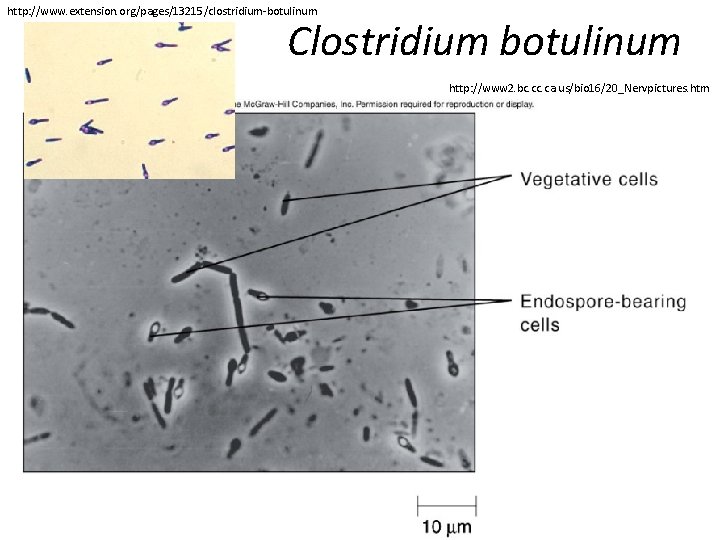 http: //www. extension. org/pages/13215/clostridium-botulinum Clostridium botulinum http: //www 2. bc. ca. us/bio 16/20_Nervpictures. htm