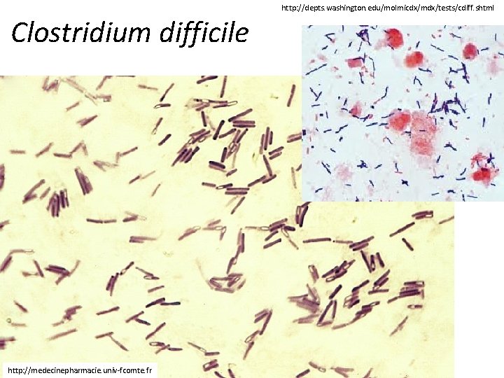 http: //depts. washington. edu/molmicdx/mdx/tests/cdiff. shtml Clostridium difficile http: //medecinepharmacie. univ-fcomte. fr 