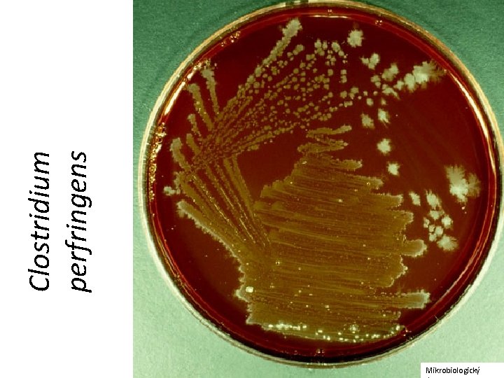 Mikrobiologický Clostridium perfringens 