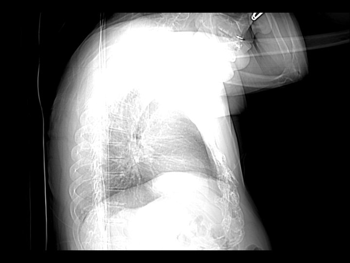 CTChest labeling by Beatrice Grasu JCESOM Class of