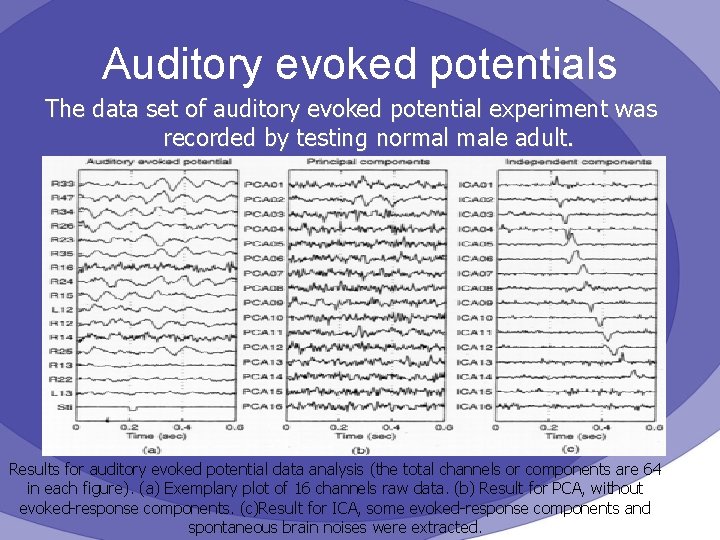 Auditory evoked potentials The data set of auditory evoked potential experiment was recorded by