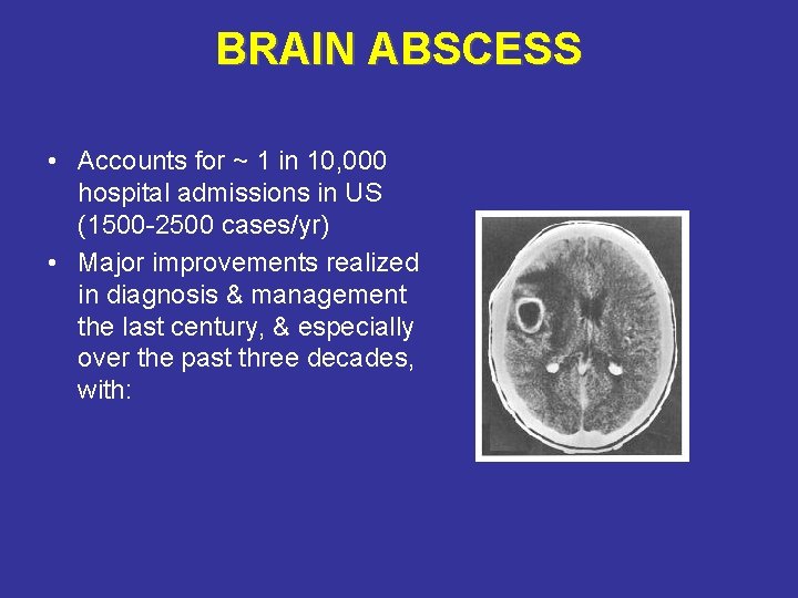 BRAIN ABSCESS • Accounts for ~ 1 in 10, 000 hospital admissions in US
