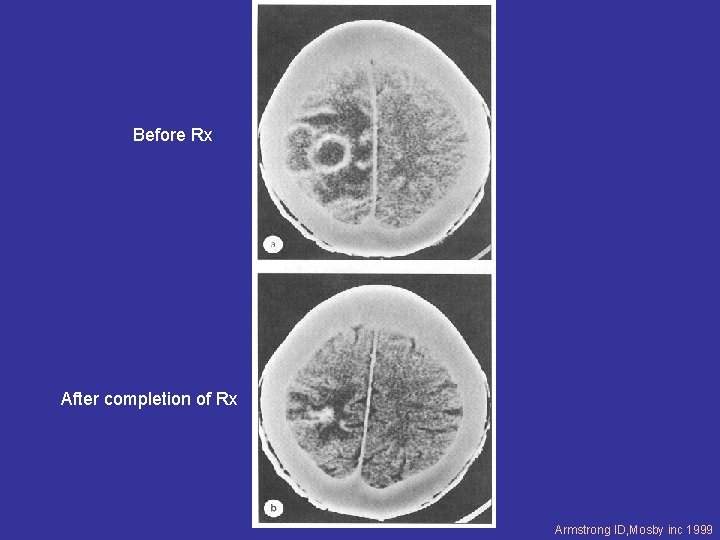 Before Rx After completion of Rx Armstrong ID, Mosby inc 1999 