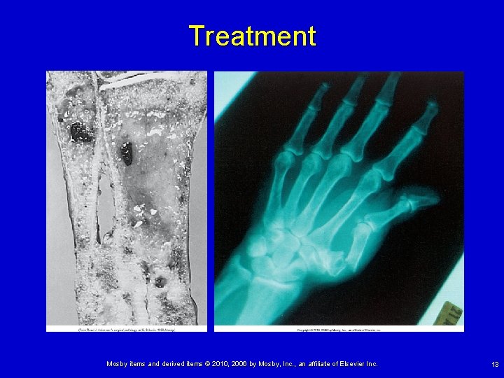 Treatment Mosby items and derived items © 2010, 2006 by Mosby, Inc. , an