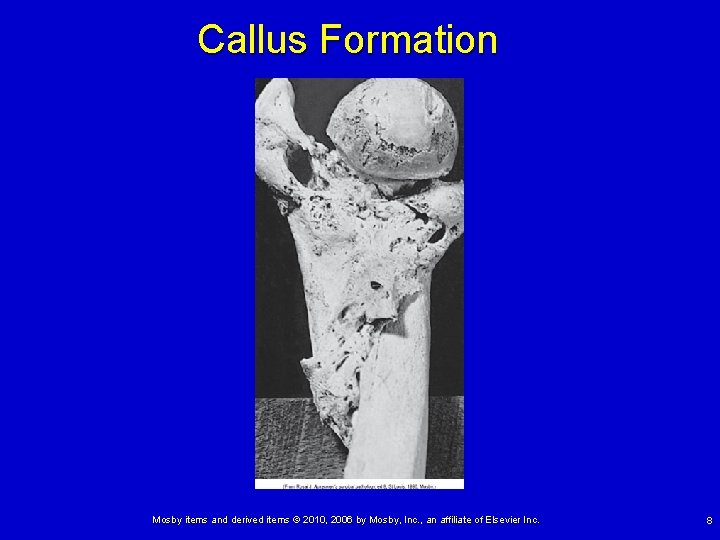 Callus Formation Mosby items and derived items © 2010, 2006 by Mosby, Inc. ,