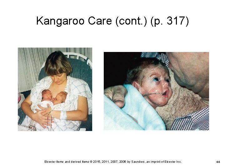 Kangaroo Care (cont. ) (p. 317) Elsevier items and derived items © 2015, 2011,