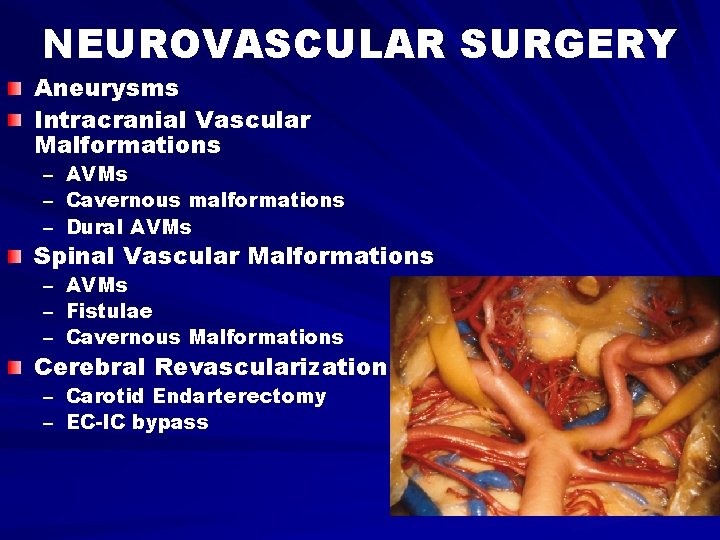 NEUROVASCULAR SURGERY Aneurysms Intracranial Vascular Malformations – – – AVMs Cavernous malformations Dural AVMs