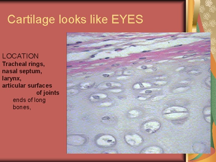 Cartilage looks like EYES LOCATION Tracheal rings, nasal septum, larynx, articular surfaces of joints