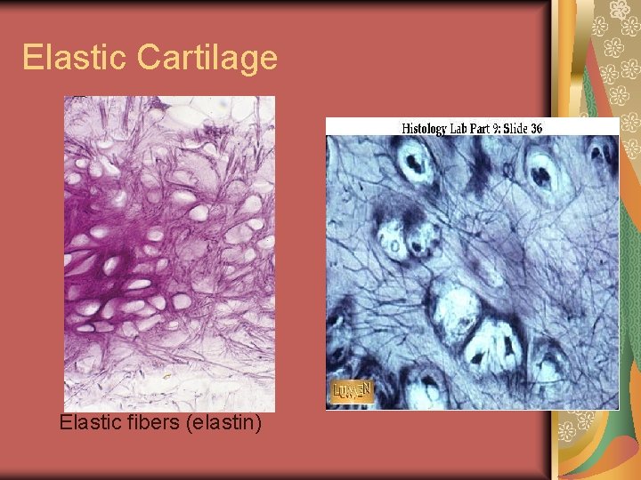 Elastic Cartilage Elastic fibers (elastin) 