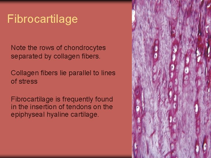 Fibrocartilage Note the rows of chondrocytes separated by collagen fibers. Collagen fibers lie parallel