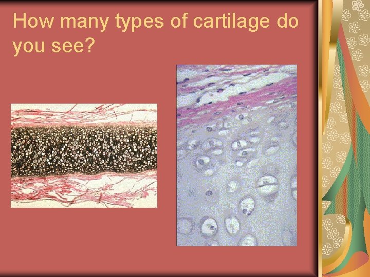 How many types of cartilage do you see? 