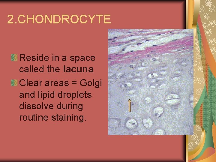 2. CHONDROCYTE Reside in a space called the lacuna Clear areas = Golgi and