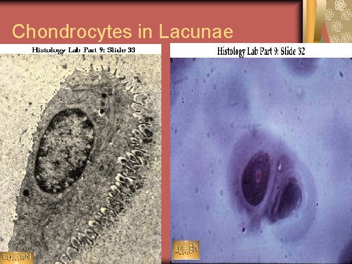 Chondrocytes in Lacunae 