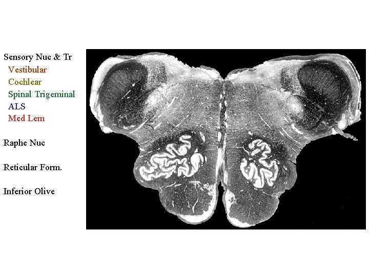 Sensory Nuc & Tr Vestibular Cochlear Spinal Trigeminal ALS Med Lem Raphe Nuc Reticular