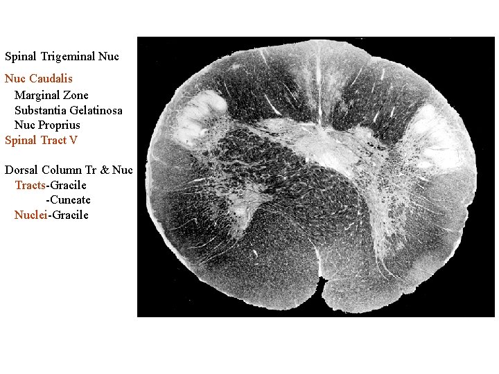 Spinal Trigeminal Nuc Caudalis Marginal Zone Substantia Gelatinosa Nuc Proprius Spinal Tract V Dorsal