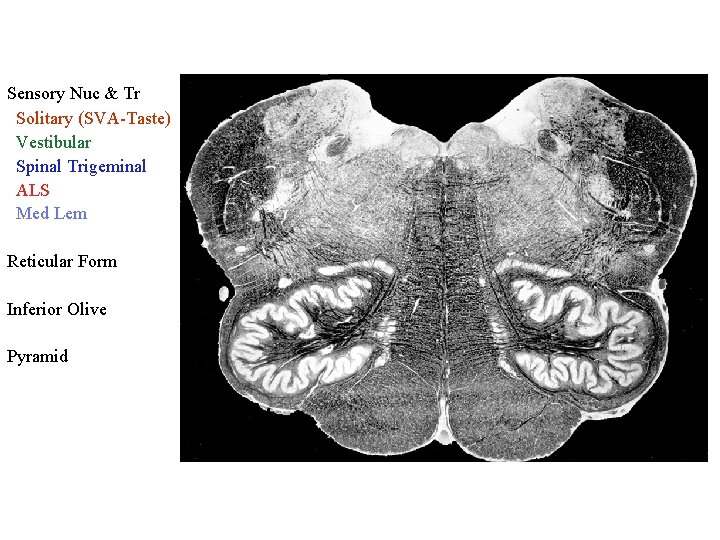 Sensory Nuc & Tr Solitary (SVA-Taste) Vestibular Spinal Trigeminal ALS Med Lem Reticular Form